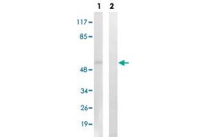 Western blot analysis of Lane 1: Untreated K562 cell lysates, Lane 2: Synthesized peptide treated K562 cell lysates reacted with AKT1/AKT3 (phospho Y437/Y434) polyclonal antibody  at 1:500-1:3000 dilution. (AKT1/3 (pTyr437), (Tyr434) anticorps)