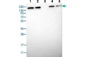 Western blot analysis of Lane 1: RT-4, Lane 2: U-251 MG, Lane 3: Human Plasma, Lane 4: Liver, Lane 5: Tonsil with UGCGL1 polyclonal antibody .