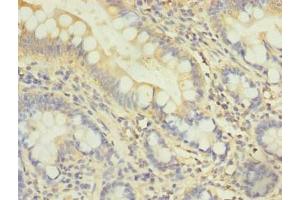 Immunohistochemistry of paraffin-embedded human small intestine tissue using ABIN7163345 at dilution of 1:100 (DDHD2 anticorps  (AA 361-650))