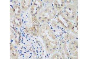 Immunohistochemistry of paraffin-embedded Rat kidney using UBE3A Polyclonal Antibody at dilution of 1:200 (40x lens).