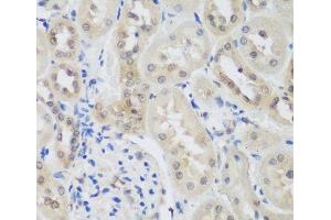 Immunohistochemistry of paraffin-embedded Rat kidney using UBE3A Polyclonal Antibody at dilution of 1:200 (40x lens). (ube3a anticorps)
