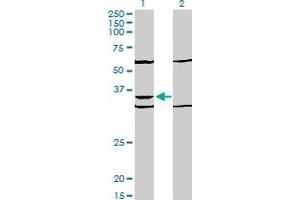 Western Blot analysis of PAX9 expression in transfected 293T cell line by PAX9 monoclonal antibody (M03), clone 4B9. (PAX9 anticorps  (AA 205-300))