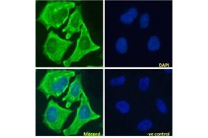 Immunofluoresence staining of fixed HeLa cells with anti-Notch 1 antibody E6. (Recombinant Notch1 anticorps)