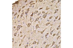 Immunohistochemistry of paraffin-embedded mouse brain using RPS14 antibody at dilution of 1:100 (x400 lens). (RPS14 anticorps)