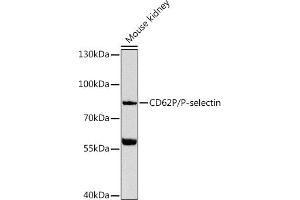 Western blot analysis of extracts of mouse kidney, using CD62P/P-selectin Antibody (ABIN6131512, ABIN6147501, ABIN6147504 and ABIN6216152) at 1:1000 dilution. (P-Selectin anticorps  (AA 220-319))
