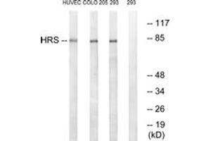 Western blot analysis of extracts from 293/COLO/HuvEc cells, using HRS (Ab-334) Antibody. (HRS (HRS) (AA 301-350) anticorps)