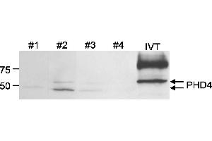 Western Blotting (WB) image for anti-Prolyl 4-Hydroxylase, Transmembrane (Endoplasmic Reticulum) (P4HTM) (C-Term) antibody (ABIN7449275) (P4HTM anticorps  (C-Term))