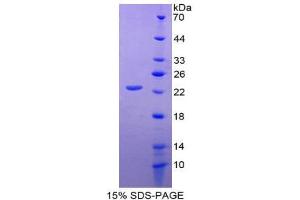 SDS-PAGE (SDS) image for CD276 (CD276) (AA 47-219) protein (His tag) (ABIN1980826)