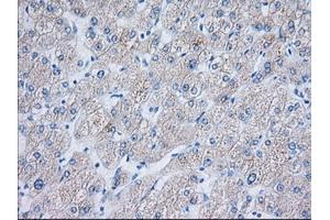 Immunohistochemical staining of paraffin-embedded Human liver tissue using anti-TTC32 mouse monoclonal antibody. (TTC32 anticorps)