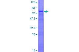 Image no. 1 for Actin, gamma 2, Smooth Muscle, Enteric (ACTG2) (AA 1-376) protein (GST tag) (ABIN1305749)