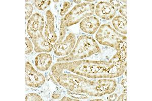Immunohistochemistry of paraffin-embedded rat kidney using IDH1 Rabbit mAb (ABIN7268027) at dilution of 1:500 (40x lens). (IDH1 anticorps)