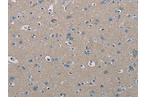 The image on the left is immunohistochemistry of paraffin-embedded Human brain tissue using ABIN7191864(PHKA2 Antibody) at dilution 1/30, on the right is treated with synthetic peptide. (PHKA2 anticorps)