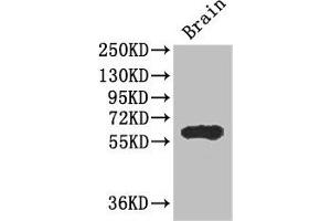 Western Blot Positive WB detected in: Mouse brain tissue All lanes: ICE1 antibody at 2. (ICE1 (AA 1213-1505) anticorps)