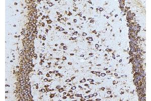 ABIN6275540 at 1/100 staining Mouse brain tissue by IHC-P. (TAO Kinase 1 (TAOK1) (Internal Region) anticorps)