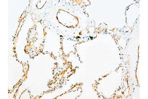 Immunohistochemistry (IHC) image for anti-Platelet/endothelial Cell Adhesion Molecule (PECAM1) antibody (ABIN108424) (CD31 anticorps)