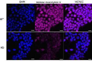 Immunocytochemical staining of HeLa cells using Histone deacetylase 8 antibody (ABIN7798937), 1:1,000), Top panel: wild-type (WT), Bottom panal: Histone deacetylase 8 shRNA knockdown (KD).
