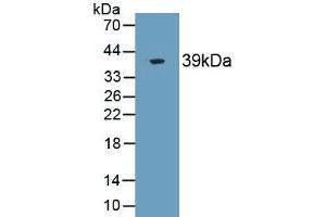 Detection of Recombinant ST2, Human using Monoclonal Antibody to Syntenin 2 (ST2) (SDCBP2 anticorps  (AA 1-292))