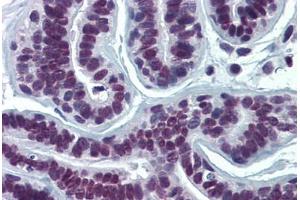 Human Breast: Formalin-Fixed, Paraffin-Embedded (FFPE) (SUMO2 anticorps  (AA 1-96))