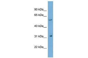 REM1 antibody used at 1 ug/ml to detect target protein. (REM1 anticorps)