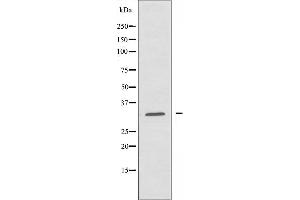 Western blot analysis of extracts from HUVEC cells, using MRPL24 antibody. (MRPL24 anticorps  (Internal Region))
