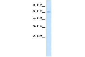 WB Suggested Anti-TRIM17 Antibody Titration:  0. (TRIM17 / RNF16 anticorps  (Middle Region))