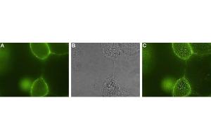 Expression of p75NTR in human A875 melanoma cells - Cell surface detection of p75NTR in live intact human A875 melanoma cells.