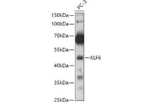 Western blot analysis of extracts of PC-3 cells, using KLF6 antibody (ABIN6131578, ABIN6142923, ABIN6142924 and ABIN6214111) at 1:500 dilution. (KLF6 anticorps  (AA 40-200))