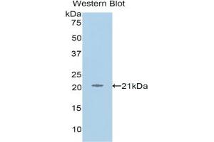 Detection of Recombinant L1CAM, Human using Polyclonal Antibody to L1-Cell Adhesion Molecule (L1CAM)