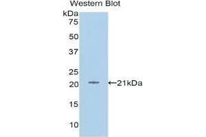 Detection of Recombinant L1CAM, Human using Polyclonal Antibody to L1-Cell Adhesion Molecule (L1CAM) (L1CAM anticorps  (AA 526-690))