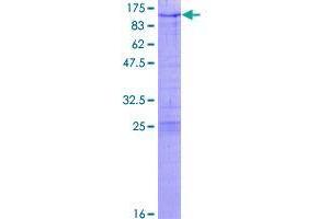 Image no. 1 for Zinc Finger Protein 274 (ZNF274) (AA 1-653) protein (GST tag) (ABIN1326055)
