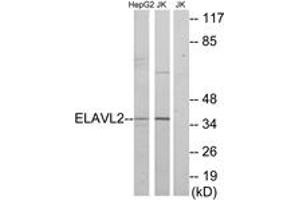 Western blot analysis of extracts from HepG2/Jurkat cells, using ELAVL2 Antibody. (ELAVL2 anticorps  (AA 11-60))
