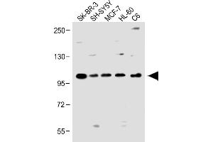 All lanes : Anti-PCDH20 Antibody (Center) at 1:1000 dilution Lane 1: SK-BR-3 whole cell lysate Lane 2: SH-SY5Y whole cell lysate Lane 3: MCF-7 whole cell lysate Lane 4: HL-60 whole cell lysate Lane 5: C6 whole cell lysate Lysates/proteins at 20 μg per lane.