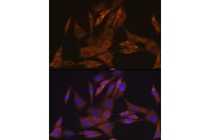 Immunofluorescence analysis of NIH-3T3 cells using KIF Rabbit mAb (ABIN7268120) at dilution of 1:100 (40x lens). (KIFAP3 anticorps)