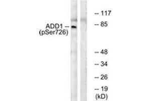 Western blot analysis of extracts from HeLa cells treated with Forskolin 40nM 30', using ADD1 (Phospho-Ser726) Antibody. (alpha Adducin anticorps  (pSer726))