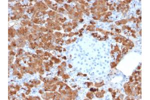Formalin-fixed, paraffin-embedded human Pancreas stained with Carboxypeptidase A1 / CPA1 Mouse Monoclonal Antibody (CPA1/2712). (CPA1 anticorps)