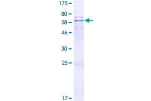 Image no. 1 for Lysophosphatidylglycerol Acyltransferase 1 (LPGAT1) (AA 1-370) protein (GST tag) (ABIN1309697)