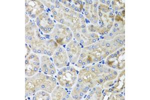 Immunohistochemistry of paraffin-embedded mouse kidney using USH1C antibody (ABIN5972448) at dilution of 1/100 (40x lens). (USH1C anticorps)