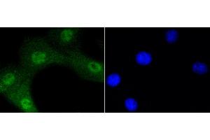 3T3 cells were stained with Akt1(Ser473) (12A1) Monoclonal Antibody  at [1:200] incubated overnight at 4C, followed by secondary antibody incubation, DAPI staining of the nuclei and detection. (AKT1 anticorps  (pSer473))