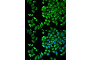 Immunofluorescence analysis of HeLa cells using WNK1 antibody. (WNK1 anticorps)