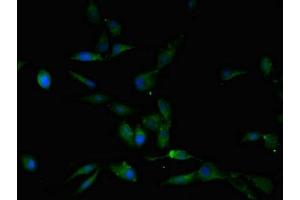 Immunofluorescent analysis of Hela cells using ABIN7163218 at dilution of 1:100 and Alexa Fluor 488-congugated AffiniPure Goat Anti-Rabbit IgG(H+L)