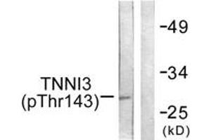 Western blot analysis of extracts from mouse heart, using TNNI3 (Phospho-Thr142) Antibody. (TNNI3 anticorps  (pThr142))