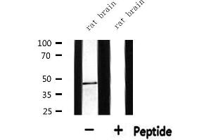 Western blot analysis of extracts from rat brain, using BCKD Antibody.