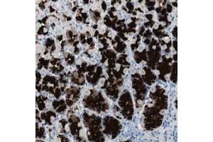 Immunohistochemical staining of human stomach with ULBP1 polyclonal antibody  shows strong cytoplasmic positivity in glandular cells at 1:50-1:200 dilution. (ULBP1 anticorps)