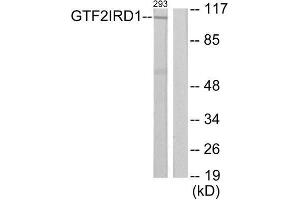 Western Blotting (WB) image for anti-General Transcription Factor II I Repeat Domain-Containing 1 (GTF2IRD1) (N-Term) antibody (ABIN1850063) (GTF2IRD1 anticorps  (N-Term))