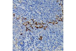 Immunohistochemistry of paraffin-embedded mouse spleen using iNOS Rabbit pAb  at dilution of 1:100 (40x lens). (NOS2 anticorps  (AA 500-730))