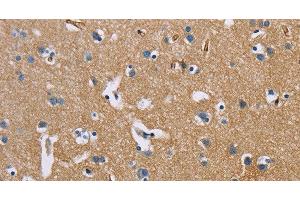 Immunohistochemistry of paraffin-embedded Human brain using BSG Polyclonal Antibody at dilution of 1:60 (CD147 anticorps)