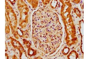 IHC image of ABIN7145298 diluted at 1:150 and staining in paraffin-embedded human kidney tissue performed on a Leica BondTM system.