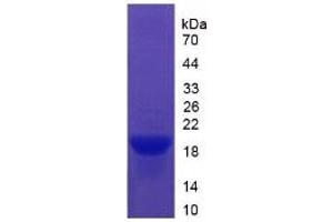 SDS-PAGE of Protein Standard from the Kit (Highly purified E. (Vitronectin Kit ELISA)