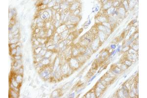 Immunohistochemistry (IHC) image for anti-Carbamoyl-Phosphate Synthetase 2, Aspartate Transcarbamylase, and Dihydroorotase (CAD) (AA 1650-1700) antibody (ABIN7448935)