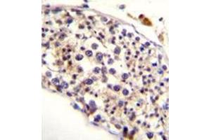 Immunohistochemistry analysis in formalin fixed and paraffin embedded human testis tissue reacted with HAUS3 Antibody (Center) followed by peroxidase conjugation of the secondary antibody and DAB staining.